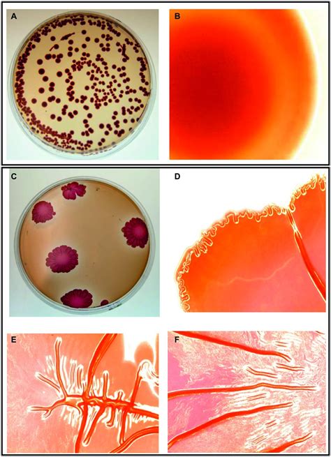 Salmonella Typhi Under Microscope - leadsgenerationmarketing