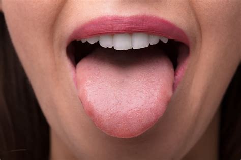 Bumps on the Tongue: Transient Lingual Papillitis - Facty Health