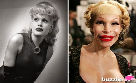 VIP Fails: Amanda Lepore plastic surgery fail