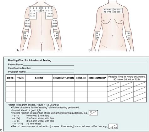 11. Parenteral Administration: Intradermal, Subcutaneous, and ...