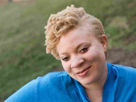 People Of Color With Albinism Ask: Where Do I Belong? : Code Switch : NPR