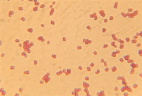 Diplococci bacteria under a light microscope (x100) : r/microscopy