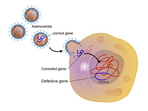 Gene Therapy