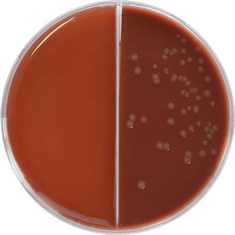 Columbia Agar with 5% Horse Blood / Columbia Chocolate Agar with 5% ...