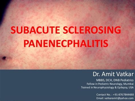 SSPE, dr. amit vatkar, pediatric neurologist