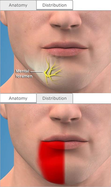 Mental Nerve Damage