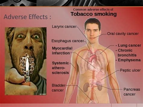 Hazards of Smoking | PPT