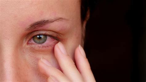 8 Signs of Eye Trauma: Retina Specialists: Retinal Ophthalmologists