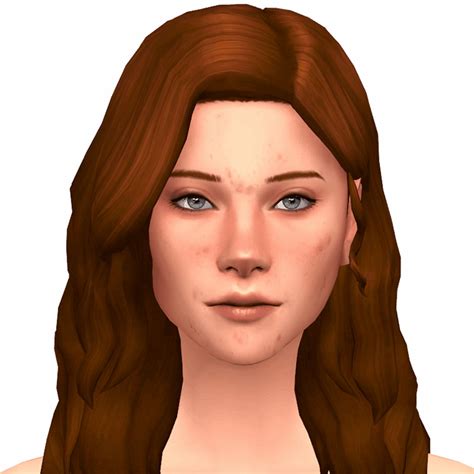 Best Sims 4 Acne Skin CC Details (All Free) – FandomSpot