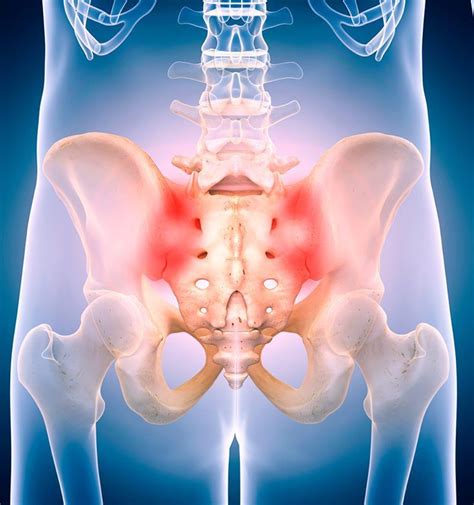 Sacroiliac Joint Injection - Delaware Valley Pain & Spine ...