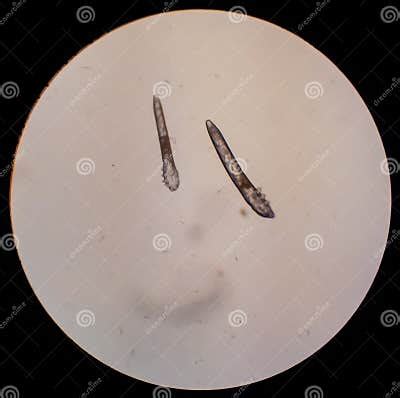 Demodex Folliculorum - Parasitic Mite on the Eyelashes of a Human Eye Stock Photo - Image of ...