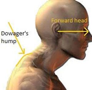 Back and Neck Pain - Is your Poor Posture to Blame?