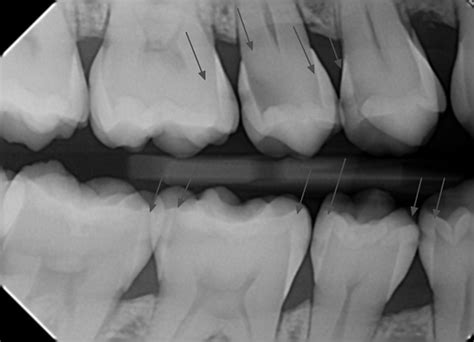 What are the different types of Digital Dental X-rays? | Palms Dentist, Shirley Christchurch ...