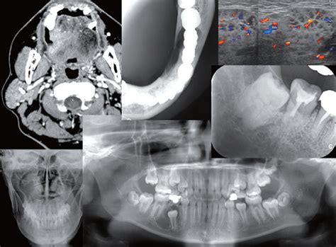 Oral and Maxillofacial Radiology | Hiroshima University