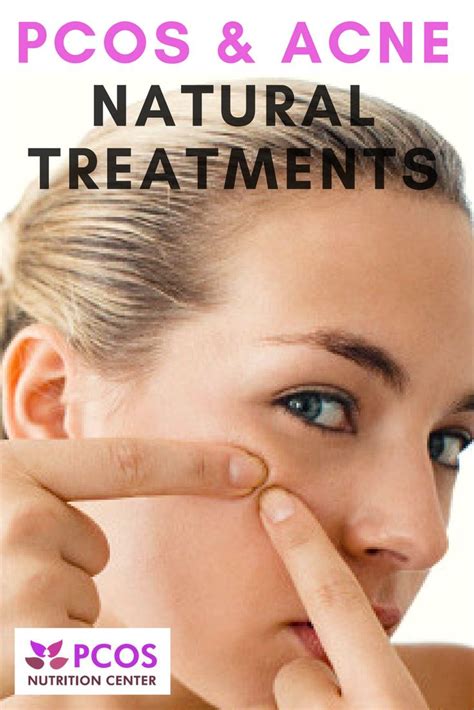 PCOS and Acne: Natural Treatment Options - PCOS Nutrition Center | Cystic acne treatment, Back ...