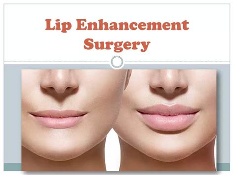 PPT - What is the cost of lip enhancement surgery in Delhi? PowerPoint Presentation - ID:8118878