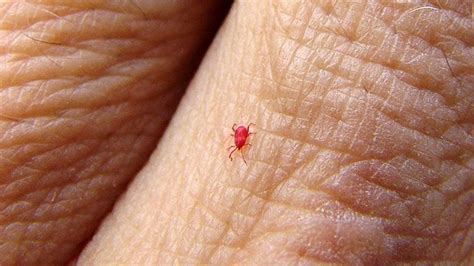 Spider Mite Bites On Humans : Spider mites do not bite human beings and are not.