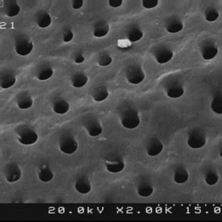 A 2000_view of the dentinal tubules openings | Download Scientific Diagram