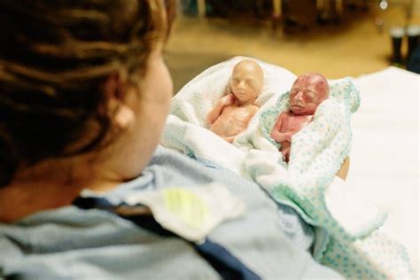 Born premature at 22 weeks, identical twins are sharing the truth about abortion - Live Action News