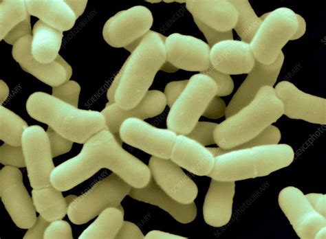 Bifidobacterium bifidum - Stock Image - B220/1561 - Science Photo Library