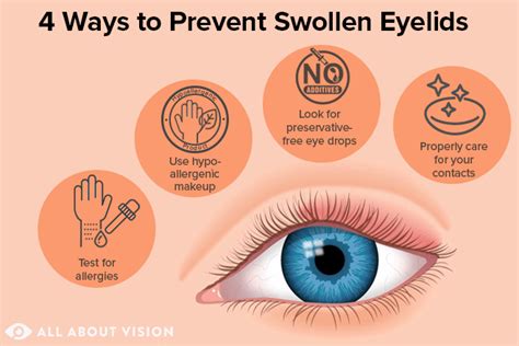 Swollen Eyelids Causes Symptoms Diagnosis Treatment R - vrogue.co
