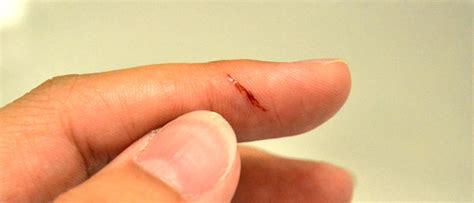 Paper Cuts Hurt so Much Because Our Fingers Are Really Sensitive | Office for Science and ...