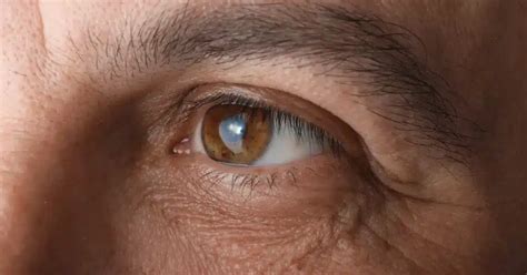 Congenital Cataracts: Symptoms, Causes, and Treatments