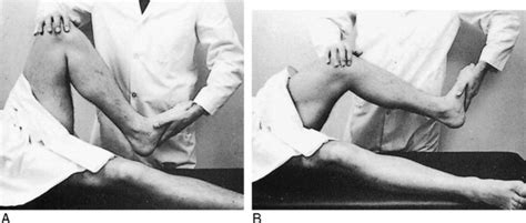 The Knee | Musculoskeletal Key