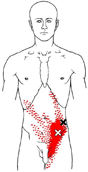 The Definitive Guide to Internal Oblique Anatomy, Exercises & Rehab