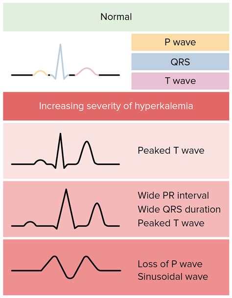 Hypokalemia Hyperkalemia Ecg