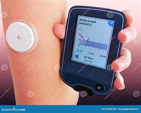 All To Know About Continuous Glucose Monitoring Cgm D - vrogue.co