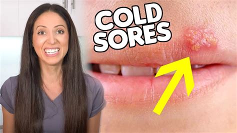 Causes Of Night Fever On Lips | Lipstutorial.org