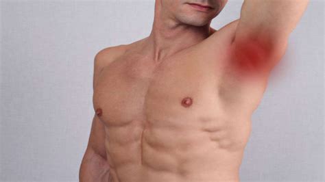 Armpit Lumps: Causes, Symptoms And Treatment - Boldsky.com