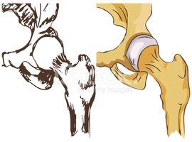 Free Hip-Joint Cliparts, Download Free Hip-Joint Cliparts png images, Free ClipArts on Clipart ...