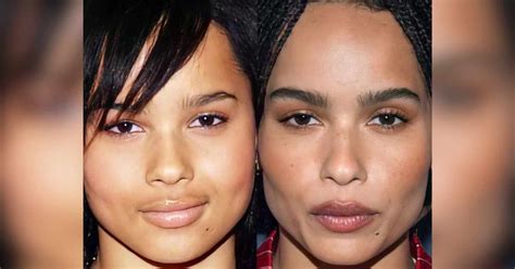 Zoe Kravitz Plastic Surgery Speculations: Unraveling the Before and After