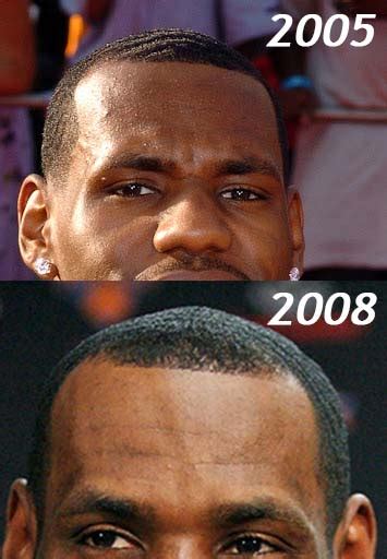 Lebron Hairline Timeline 2022