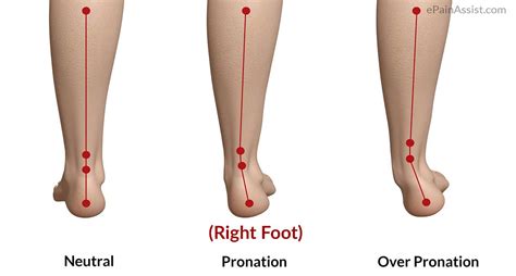 The Pronation Of Foot