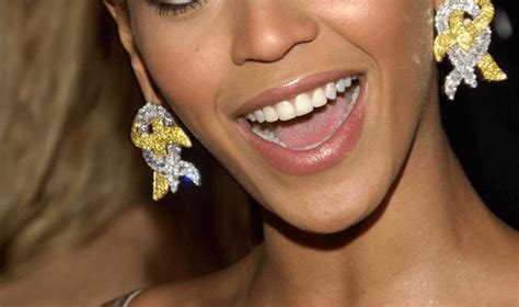 beyonce-braces-smile-teeth | Gladwell Orthodontics