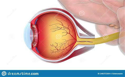 Glaucoma is an Eye Condition that Damages the Optic Nerve, Which is Vital for Good Vision Stock ...