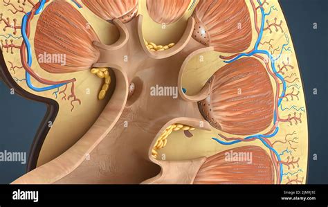 Stone of kidney hi-res stock photography and images - Alamy