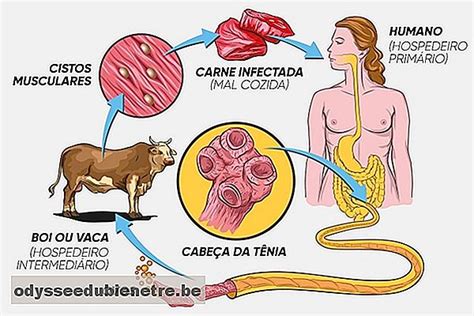 Síntomas de la Teniasis y cómo confirmar - es.odysseedubienetre.be