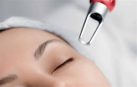 Why PICO LASER is the best treatment for MELASMA? - Stamford Skin Centre