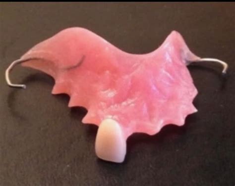 Flipper Denture Appliance - Etsy