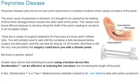 Peyronies Disease | www.imgkid.com - The Image Kid Has It!