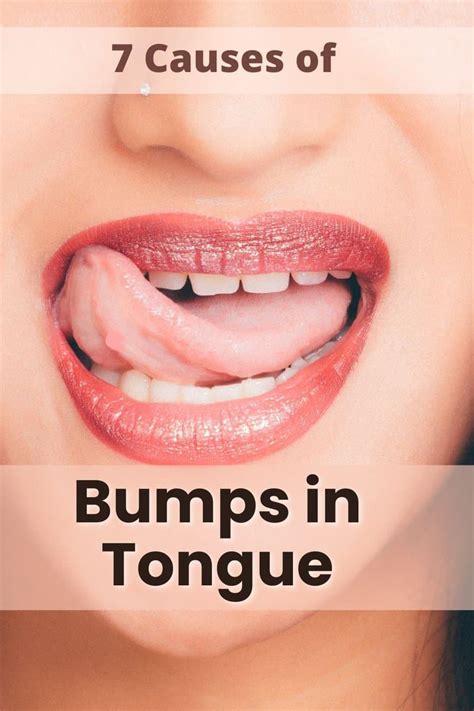 7 Causes of Bumps in The Back Of Your Tongue? MG