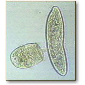 Didinium | Microbus Microscope Educational Website