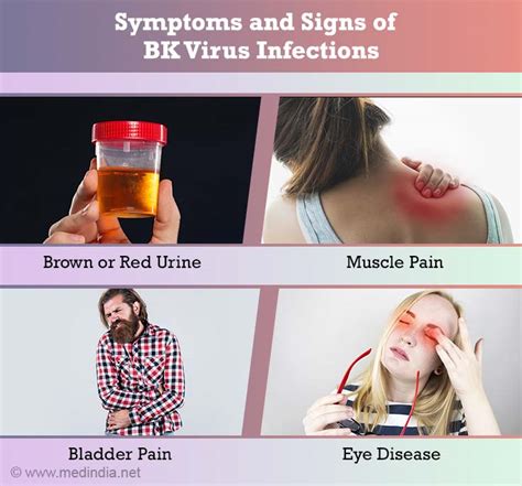 BK Virus Infection - Risk Factors, Symptoms, Signs, Diagnosis, Treatment, Prognosis