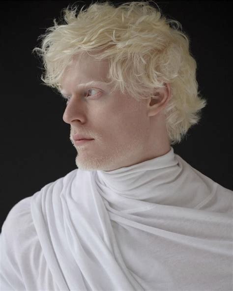 White Out (Schön Magazine) | Rostos humanos, Modelo albino, Fotografia conceitual