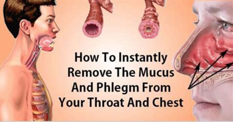 How To Eliminate Mucus And Phlegm From Your Throat And Chest (Instant ...