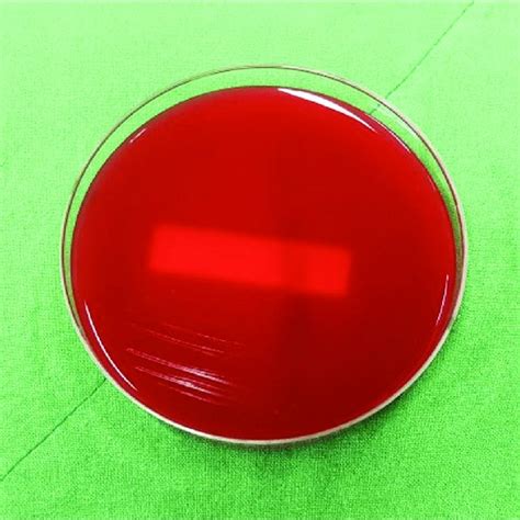 Image of blood agar plate medium which culture sample exposed to ...